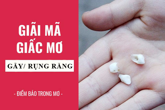 Giải Mã Những Giấc Mơ Rụng Răng Thường Gặp – Tốt Hay Xấu?